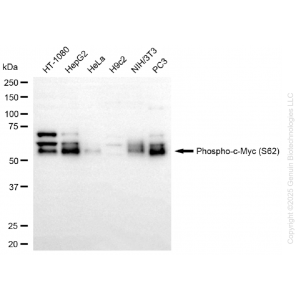 KD-Validated Phospho-MYC (S62) Rabbit mAb (20 μl)