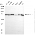 KD-Validated MEN1 Rabbit mAb (20 μl)