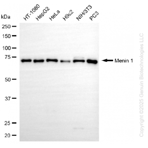KD-Validated MEN1 Rabbit mAb (20 μl)