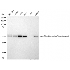 KD-Validated GSR Rabbit mAb (20 μl)