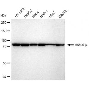 KD-Validated Hsp90 beta Rabbit mAb (20 μl)