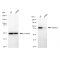 KD-Validated Hsp90 beta Rabbit mAb (20 μl)