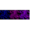 KD-Validated PFKM Rabbit mAb (20 μl)