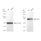 KD-Validated PFKM Rabbit mAb (20 μl)