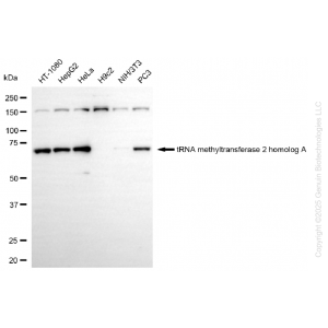 KD-Validated TRMT2A Rabbit mAb (20 μl)