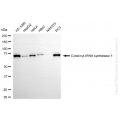 KD-Validated CARS1 Rabbit mAb (20 μl)