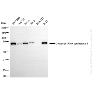KD-Validated CARS1 Rabbit mAb (20 μl)