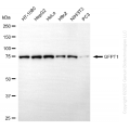 KD-Validated GFPT1 Rabbit mAb (20 μl)