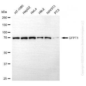 KD-Validated GFPT1 Rabbit mAb (20 μl)