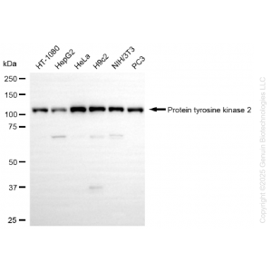 KD-Validated PTK2 Rabbit mAb (20 μl)