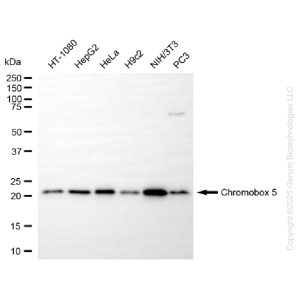 KD-Validated CBX5 Rabbit mAb (20 μl)