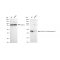 KD-Validated ACAA2 Rabbit mAb (20 μl)