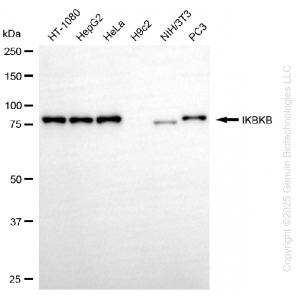 KD-Validated IKBKB Rabbit mAb (20 μl)