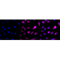 KD-Validated AP2M1 Rabbit mAb (20 μl)