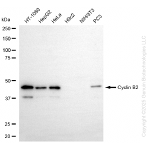 KD-Validated CCNB2 Rabbit mAb (20 μl)