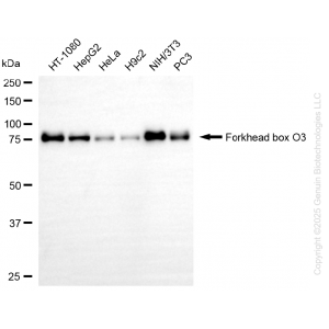 KD-Validated FOXO3 Rabbit mAb (20 μl)
