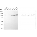 KD-Validated NFKB2 Rabbit mAb (20 μl)