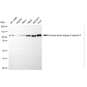 KD-Validated NFKB2 Rabbit mAb (20 μl)
