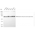 KD-Validated MELK Rabbit mAb (20 μl)