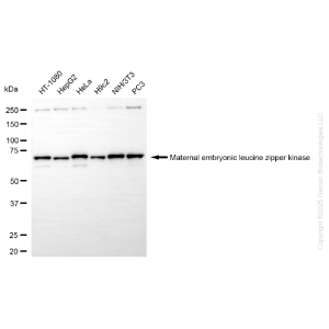 KD-Validated MELK Rabbit mAb (20 μl)