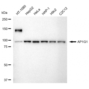 KD-Validated AP1G1 Rabbit mAb (20 μl)
