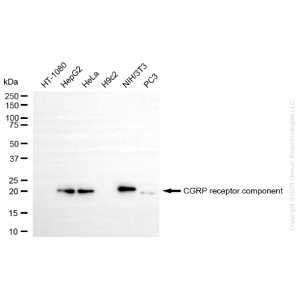 KD-Validated CRCP Rabbit mAb (20 μl)