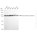 KD-Validated EXOC2 Rabbit mAb (20 μl)