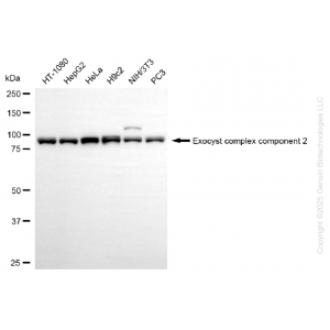 KD-Validated EXOC2 Rabbit mAb (20 μl)