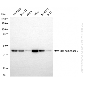 KD-Validated LHX3 Rabbit mAb (20 μl)