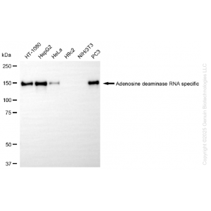 KD-Validated ADAR Rabbit mAb (20 μl)