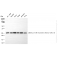 KD-Validated EIF4E Rabbit mAb (20 μl)