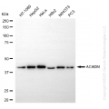 KD-Validated ACADM Rabbit mAb (20 μl)
