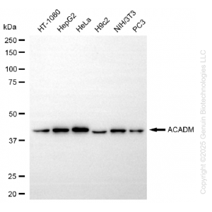KD-Validated ACADM Rabbit mAb (20 μl)