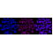 KD-Validated ATP7B Rabbit mAb (20 μl)
