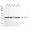 KD-Validated SNRPA1 Rabbit mAb (20 μl)