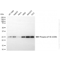 KD-Validated Phospho-eIF4E (S209) Rabbit mAb (20 μl)