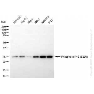 KD-Validated Phospho-eIF4E (S209) Rabbit mAb (20 μl)