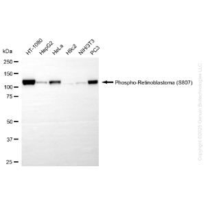 KD-Validated Phospho-RB1 (S807) Rabbit mAb (20 μl)