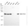 KD-Validated STK39 Rabbit mAb (20 μl)