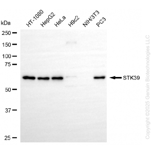 KD-Validated STK39 Rabbit mAb (20 μl)