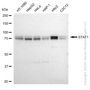 KD-Validated STAT1 Rabbit mAb (20 μl)