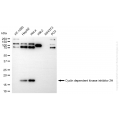 KD-Validated CDKN2A Rabbit mAb (20 μl)