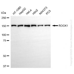 KD-Validated ROCK1 Rabbit mAb (20 μl)