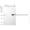 KD-Validated Phospho-VIM (Ser72) Rabbit mAb (20 μl)
