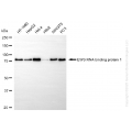 KD-Validated EWSR1 Rabbit mAb (20 μl)