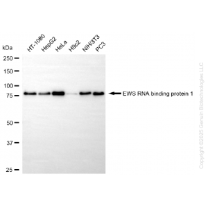 KD-Validated EWSR1 Rabbit mAb (20 μl)