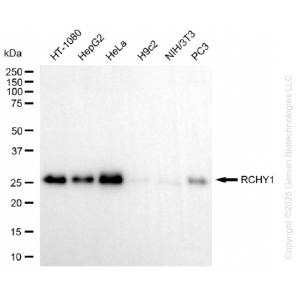 KD-Validated RCHY1 Rabbit mAb (20 μl)