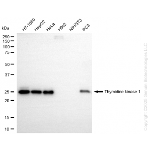 KD-Validated TK1 Rabbit mAb (20 μl)