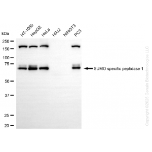 KD-Validated SENP1 Rabbit mAb (20 μl)