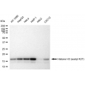 KD-Validated Histone H3 (acetyl K27) Rabbit mAb (20 μl)